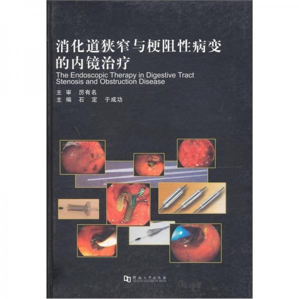 消化道狹窄與梗阻性病變的內(nèi)鏡治療