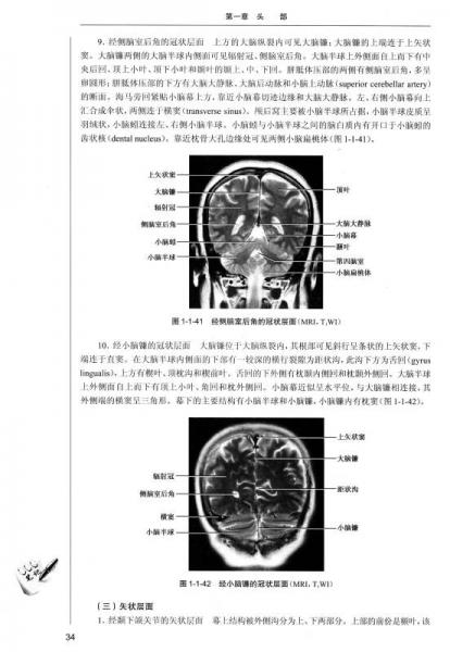 医学影像解剖学/国家卫生计划生育委员会“十二五”规划教材