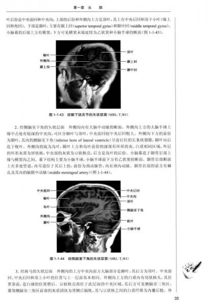 医学影像解剖学/国家卫生计划生育委员会“十二五”规划教材