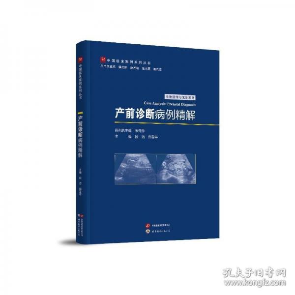 产前诊断病例精解