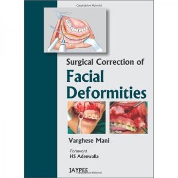 SURGICAL CORRECTION OF FACIAL DEFORMITIE