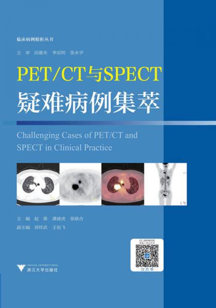 PET/CT与SPECT疑难病例集萃  临床精析病例集锦