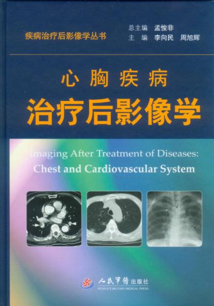 疾病治疗后影像学丛书：心胸疾病治疗后影像学