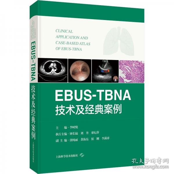 EBUS-TBNA技术及经典案例