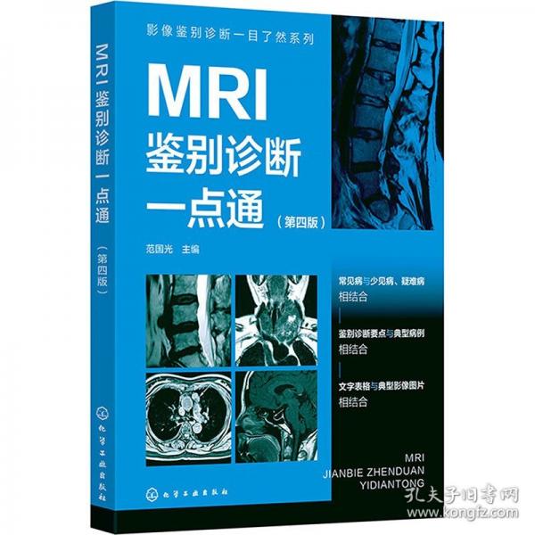 影像鉴别诊断一目了然系列--MRI鉴别诊断一点通
