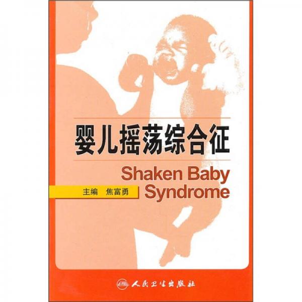 嬰兒搖蕩綜合征