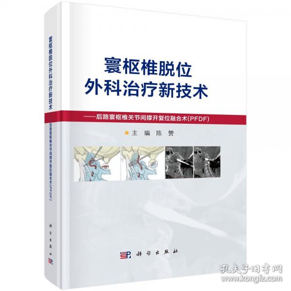 寰樞椎脫位外科新技術(shù)——后路寰樞椎關(guān)節(jié)間撐開復(fù)位融合術(shù)（PFDF）