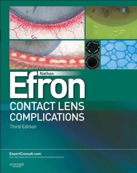 Contact Lens Complications, 3rd Edition (Expert Consult: Online and Print)