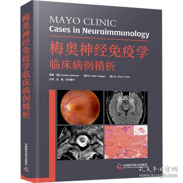 梅奥神经免疫学临床病例精析