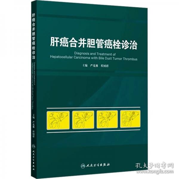肝癌合并膽管癌栓診治
