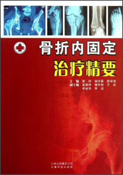 骨折內(nèi)固定治療精要