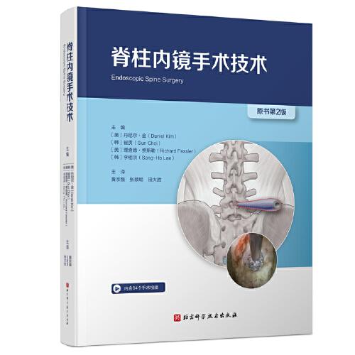 脊柱內(nèi)鏡手術(shù)技術(shù)