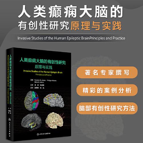 人类癫痫大脑的有创性研究：原理与实践
