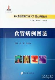 食管癌规范化诊治指南