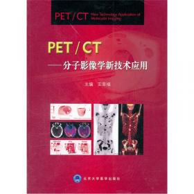 PET/CT肿瘤诊断学