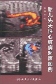 胎儿超声心动图实用手册