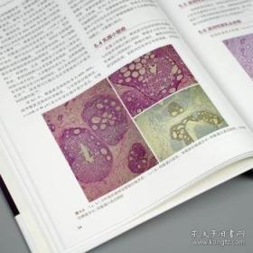 乳腺癌保乳治疗