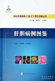 肝胆病自我调养