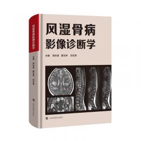 风湿病防治130问