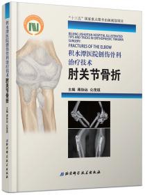 积水潭医院创伤骨科手术技术：足踝骨折